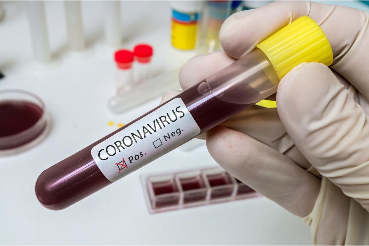 Плюс 211 случаев коронавируса за сутки