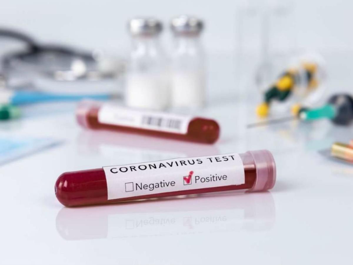 Плюс 160 случаев коронавируса за сутки